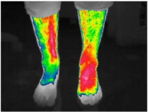 After treatment of 5 minutes at 35 Hz.