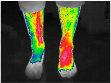 After treatment of 5 minutes at 35 Hz. After treatment of 5 minutes at 35 Hz.