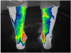 Heatmap of back of a persons legs