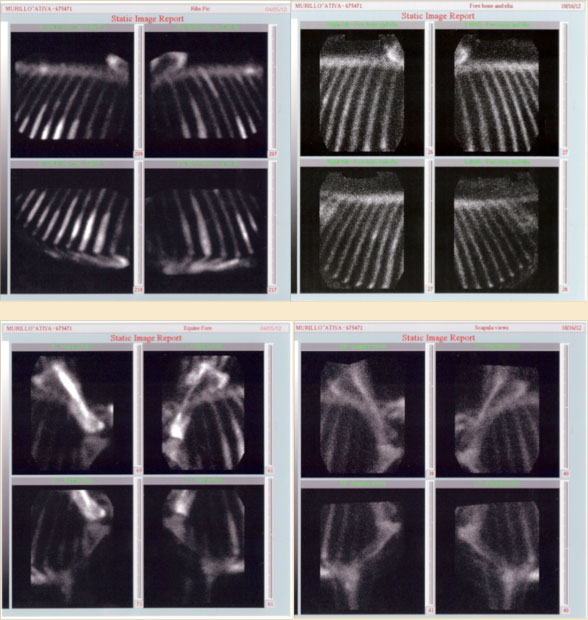 Horse bone density x rays on case studies