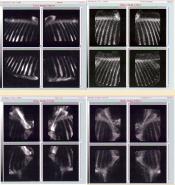 bone-density Horse bone density x rays on case studies