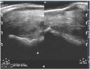 Tendon and ligament xray images