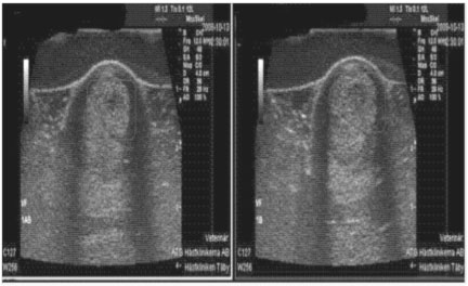 Tendon and ligament x-ray images