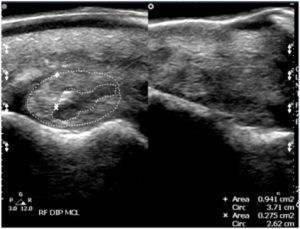 Tendon and ligament xray images