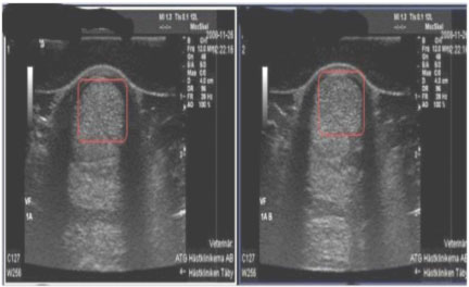 Xray images of tendon and ligament